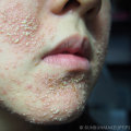 Is facial good for skin or not?