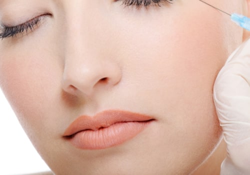 Botox In Los Angeles: What You Need To Know