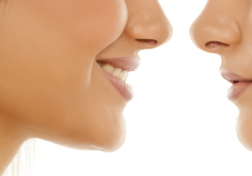 Plastic Surgery Vs. Med Spa Treatment: Where Should You Go For Your Rhinoplasty In Seattle, WA?